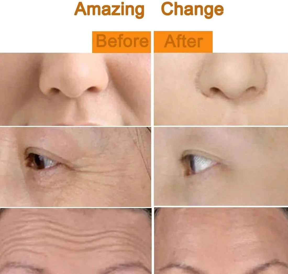 SkinAura Gold Facial Massager